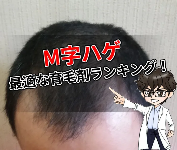 M字ハゲ・最適・育毛剤・ランキング