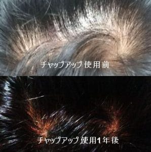 チャップアップ・育毛剤