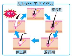 ヘアサイクル02