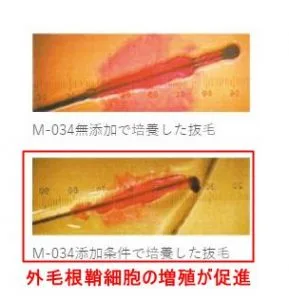 外毛根鞘