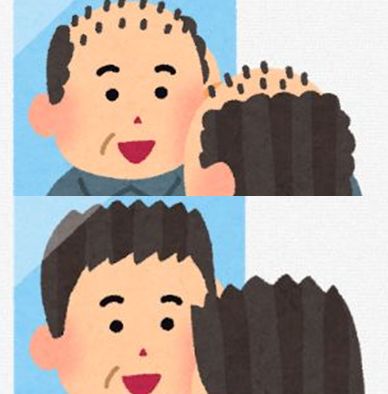 AGAクリニック・嘘02